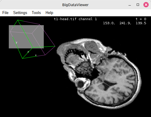 BigDataViewer